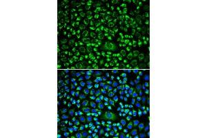 Immunofluorescence analysis of HeLa cells using TAPBP antibody (ABIN6132744, ABIN6148847, ABIN6148849 and ABIN6217320). (TAPBP 抗体  (AA 30-260))