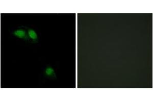 Immunofluorescence analysis of HeLa cells, using IRS-1 (Phospho-Ser312) Antibody. (IRS1 抗体  (pSer312))