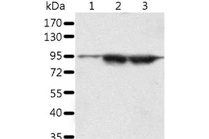 Western Blot analysis of A549 and lncap cell, Human seminoma tissue using SPATA20 Polyclonal Antibody at dilution of 1:1000 (SPATA20 抗体)