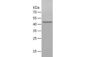Western Blotting (WB) image for Squalene Epoxidase (SQLE) (AA 49-275) protein (His-IF2DI Tag) (ABIN7125197) (SQLE Protein (AA 49-275) (His-IF2DI Tag))