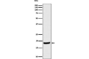 anti-Eukaryotic Translation Initiation Factor 1A, X-Linked (EIF1AX) antibody