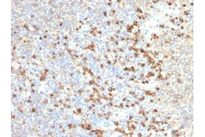 Formalin-fixed, paraffin-embedded human Tonsil stained with TIM3 Mouse Monoclonal Antibody (TIM3/2399). (TIM3 抗体  (AA 22-202))