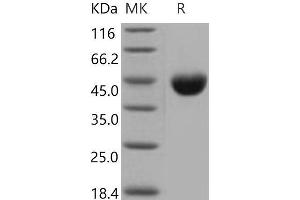 Western Blotting (WB) image for Poliovirus Receptor-Related 2 (Herpesvirus Entry Mediator B) (PVRL2) (Active) protein (His tag) (ABIN7320318)