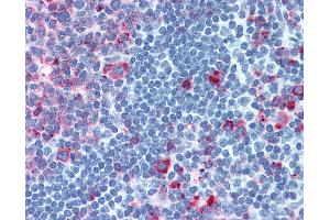 Immunohistochemistry (IHC) image for anti-Cadherin EGF LAG Seven Pass G-Type Receptor 1 (CELSR1) (C-Term) antibody (ABIN1048425)