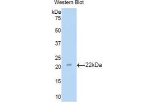 Western blot analysis of the recombinant protein. (LAMC3 抗体  (AA 1250-1418))