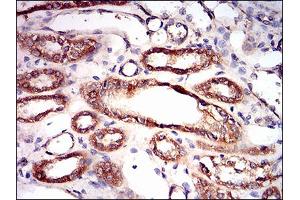 Immunohistochemistry (IHC) image for anti-Protein Kinase, AMP-Activated, gamma 1 Non-Catalytic Subunit (PRKAG1) (AA 230-331) antibody (ABIN1724932)