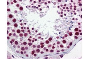 IHC Information: Paraffin embedded testis tissue, tested with an antibody dilution of 5 ug/ml.