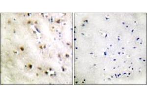 Immunohistochemistry analysis of paraffin-embedded human brain tissue, using TISB (Ab-92) Antibody. (ZFP36L1 抗体  (AA 58-107))