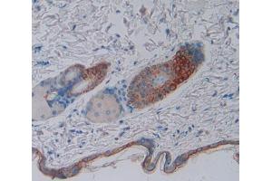 Used in DAB staining on fromalin fixed paraffin- embedded skin tissue (BOC 抗体  (AA 668-866))