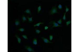 Image no. 1 for anti-Cancer/testis Antigen 1B (CTAG1B) antibody (ABIN1499895) (CTAG1B 抗体)