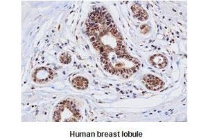 Immunohistochemistry (IHC) image for anti-Cathepsin D (CTSD) (AA 21-412) antibody (ABIN317502) (Cathepsin D 抗体  (AA 21-412))