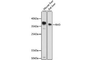 Western blot analysis of extracts of various cell lines using RHD Polyclonal Antibody at dilution of 1:1000. (RHD 抗体)