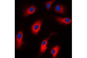 Immunofluorescent analysis of Caspase 7 staining in Jurkat cells. (Caspase 7 抗体  (N-Term))