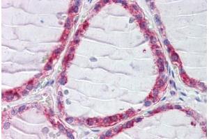 Human Thyroid (formalin-fixed, paraffin-embedded) stained with CLIP1 antibody ABIN462301 followed by biotinylated secondary antibody, alkaline phosphatase-streptavidin and chromogen. (CLIP1 抗体  (AA 1404-1417))