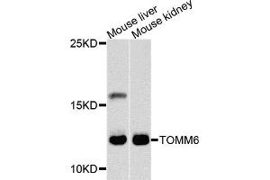 Western blot analysis of extracts of mouse liver and mouse kidney cells, using TOMM6 antibody. (TOMM6 抗体)