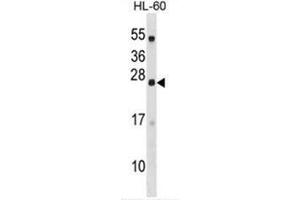 C18orf26 Antibody (N-term) western blot analysis in HL-60 cell line lysates (35µg/lane). (DYNAP 抗体  (N-Term))