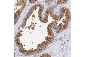 Immunohistochemistry (Formalin/PFA-fixed paraffin-embedded sections) of human prostate with GAL3ST1 polyclonal antibody  shows strong granular cytoplasmic positivity in glandular cells. (GAL3ST1 抗体)