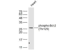Image no. 4 for anti-B-Cell CLL/lymphoma 2 (BCL2) (pThr129) antibody (ABIN756622)
