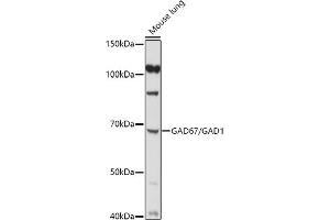 Western Blotting (WB) image for anti-Glutamate Decarboxylase 1 (Brain, 67kDa) (GAD1) (AA 1-200) antibody (ABIN3017019)