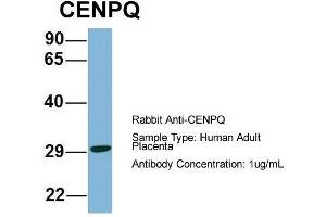 Host: Rabbit  Target Name: CENPQ  Sample Tissue: Human Adult Placenta  Antibody Dilution: 1.