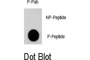 Image no. 1 for anti-Ribosomal Protein S6 Kinase, 90kDa, Polypeptide 3 (RPS6KA3) (pSer369) antibody (ABIN358394) (RPS6KA3 抗体  (pSer369))