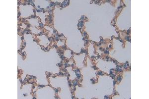 #VALUE! (CSK 抗体  (AA 243-438))
