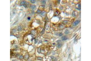 Used in DAB staining on fromalin fixed paraffin-embedded lung tissue (CD93 抗体  (AA 82-369))