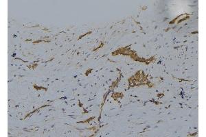 ABIN6277730 at 1/100 staining Human lung tissue by IHC-P.