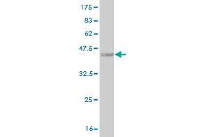 Western Blot detection against Immunogen (36. (HOXA5 抗体  (AA 171-270))