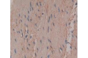 IHC-P analysis of Human Tissue, with DAB staining. (TNNT3 抗体  (AA 147-269))