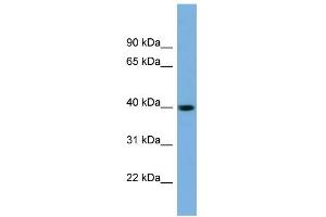 WB Suggested Anti-SAE1 Antibody Titration: 0. (SAE1 抗体  (N-Term))