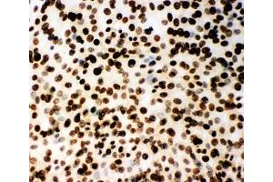 Immunocytochemistry (ICC) image for anti-Minichromosome Maintenance Complex Component 2 (MCM2) (AA 884-904) antibody (ABIN3031803)