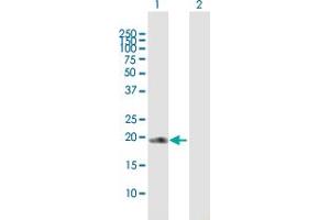 Western Blot analysis of COPS8 expression in transfected 293T cell line by COPS8 MaxPab polyclonal antibody. (COPS8 抗体  (AA 1-209))