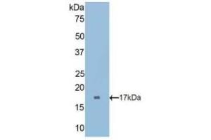 Detection of Recombinant CUBN, Rat using Polyclonal Antibody to Cubilin (CUBN) (CUBN 抗体  (AA 3157-3274))