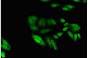 Immunofluorescent analysis of Hela cells using ABIN7150955 at dilution of 1:100 and Alexa Fluor 488-congugated AffiniPure Goat Anti-Rabbit IgG(H+L) (EGR2 抗体  (AA 42-245))
