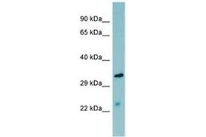 Image no. 1 for anti-Mannan-Binding Lectin serine Peptidase 2 (MASP2) (AA 35-84) antibody (ABIN6741648) (MASP2 抗体  (AA 35-84))