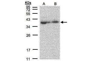 WB Image Sample(30 μg of whole cell lysate) A:293T B:A431, 12% SDS PAGE antibody diluted at 1:500 (MRPL3 抗体  (C-Term))