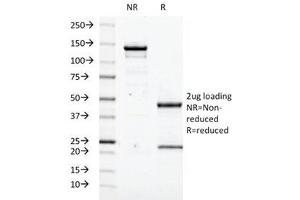 SDS-PAGE Analysis of Purified, BSA-Free Transglutaminase 2 Antibody (clone TGM2/419). (Transglutaminase 2 抗体)