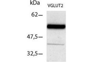 Western Blot analysis using VGLUT2 antibody Cat.