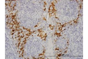 Immunoperoxidase of monoclonal antibody to GSTA3 on formalin-fixed paraffin-embedded human tonsil. (GSTA3 抗体  (AA 1-222))