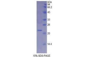 SDS-PAGE analysis of Human MYL4 Protein.