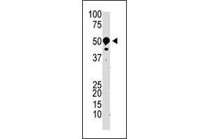 Image no. 1 for anti-Suppressor of Variegation 3-9 Homolog 2 (Drosophila) (SUV39H2) (N-Term) antibody (ABIN356790) (SUV39H2 抗体  (N-Term))