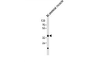 Western blot analysis of lysate from mouse skeletal muscle tissue, using Dbx1 Antibody (C-term) (ABIN6243427 and ABIN6577688). (DBX1 抗体  (C-Term))