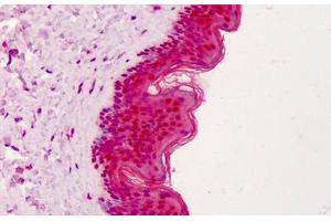 Human Skin: Formalin-Fixed, Paraffin-Embedded (FFPE) (APEX1 抗体)
