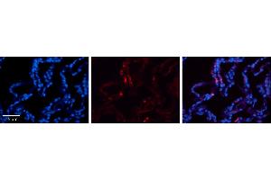 Rabbit Anti-CRIP2 Antibody     Formalin Fixed Paraffin Embedded Tissue: Human Lung Tissue  Observed Staining: Cytoplasmic in alveolar type I cells  Primary Antibody Concentration: 1:100  Other Working Concentrations: 1/600  Secondary Antibody: Donkey anti-Rabbit-Cy3  Secondary Antibody Concentration: 1:200  Magnification: 20X  Exposure Time: 0. (CRIP2 抗体  (Middle Region))