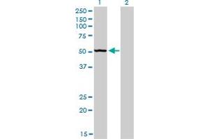 Western Blot analysis of BFAR expression in transfected 293T cell line by BFAR monoclonal antibody (M01), clone 1C6. (BFAR 抗体  (AA 101-200))