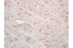 Formalin-fixed and paraffin embedded rat brain labeled with Rabbit Anti ARTS Polyclonal Antibody, Unconjugated (ABIN872659) at 1:200 followed by conjugation to the secondary antibody and DAB staining (Septin 4 抗体  (AA 91-150))