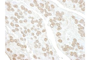anti-Polymerase (RNA) III (DNA Directed) Polypeptide D, 44kDa (POLR3D) (AA 175-225) antibody