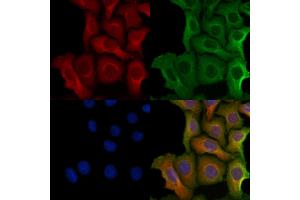 ABIN6264594 and ABIN6279749 staining Hela cells by IF/ICC. (RAB9B 抗体  (Internal Region))