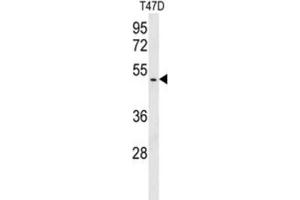 Western Blotting (WB) image for anti-BRISC and BRCA1 A Complex Member 1 (BABAM1) antibody (ABIN3003809) (BRISC and BRCA1 A Complex Member 1 (BABAM1) 抗体)